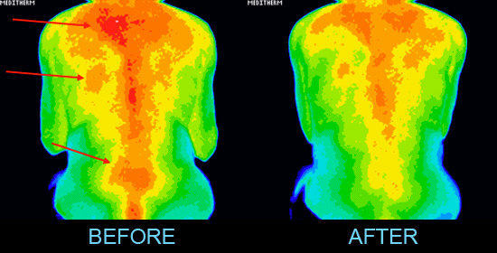 Thermal Images